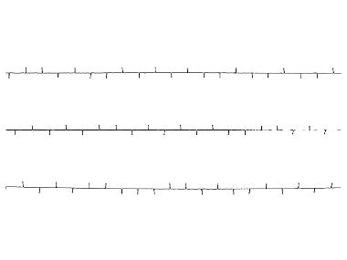 LIVARNO home LED-Lichterkette