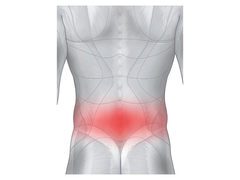 Anatomische Abbildung, die Rückenschmerzen zeigt.
