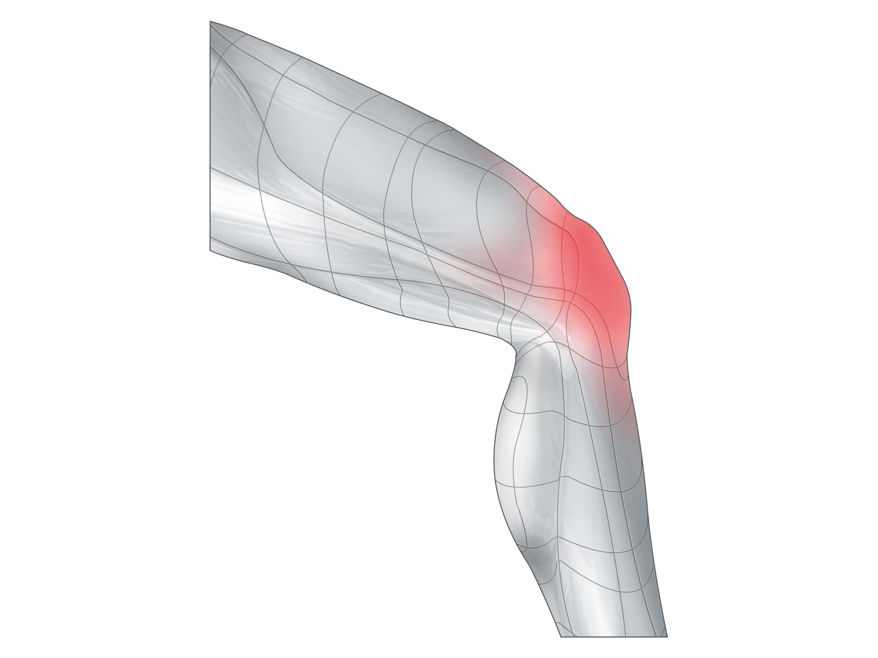 Thumbnail - sensiplast® Kniegelenkbandage (XL)